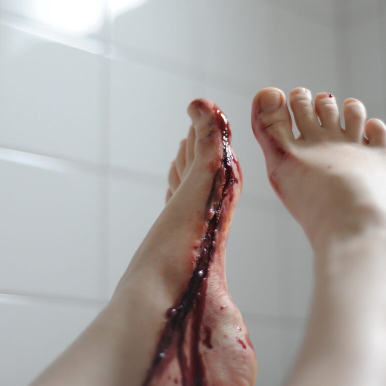 sfx,fx-smink,Specialeffekter,reklam,TV,sår,ärr,sårsmink,sårsminkning,Stockholm,Makeupartist,Makeup artist,scensmink,teatersmink