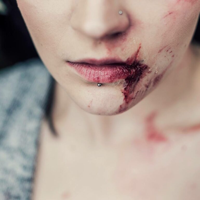 sfx,fx-smink,Specialeffekter,reklam,TV,sår,ärr,sårsmink,sårsminkning,Stockholm,Makeupartist,Makeup artist,scensmink,teatersmink